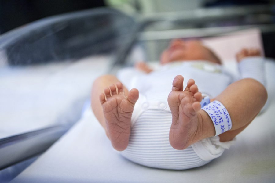 Infant with PKU_DietitiansOnDemand
