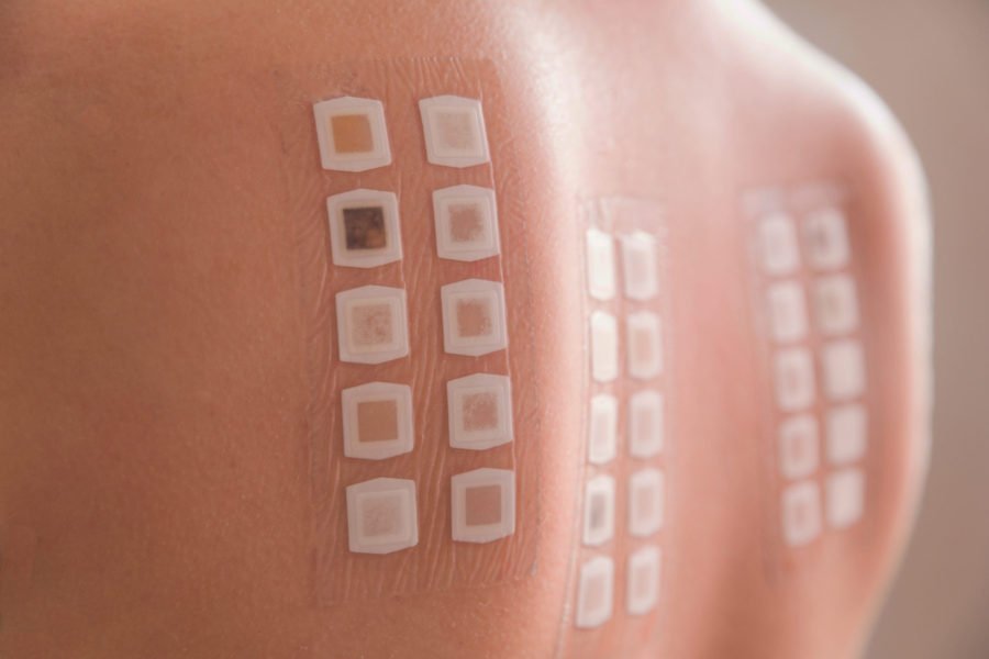 Allergy patch test_Dietitians On Demand