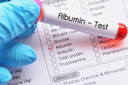 albumin_Dietitians On Demand