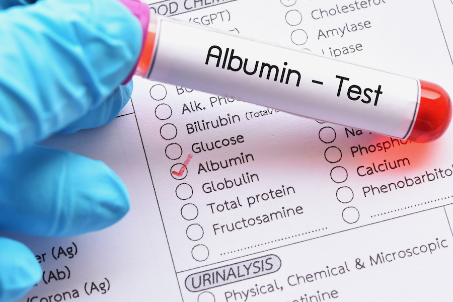 albumin_Dietitians On Demand
